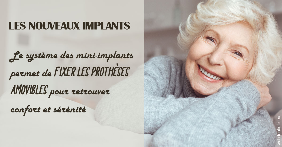 https://dr-doucet-philippe.chirurgiens-dentistes.fr/Les nouveaux implants 1