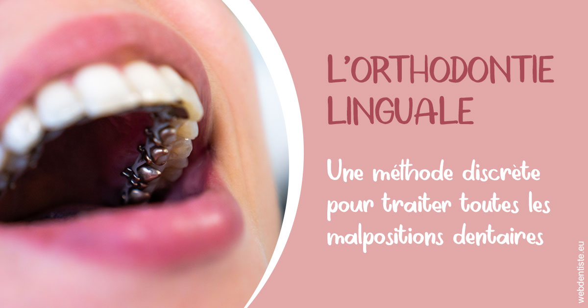 https://dr-doucet-philippe.chirurgiens-dentistes.fr/L'orthodontie linguale 2