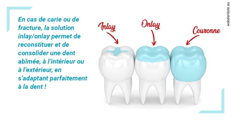 https://dr-doucet-philippe.chirurgiens-dentistes.fr/L'INLAY ou l'ONLAY