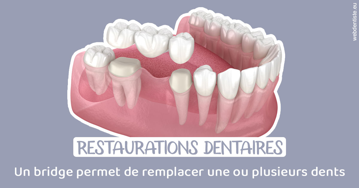 https://dr-doucet-philippe.chirurgiens-dentistes.fr/Bridge remplacer dents 1