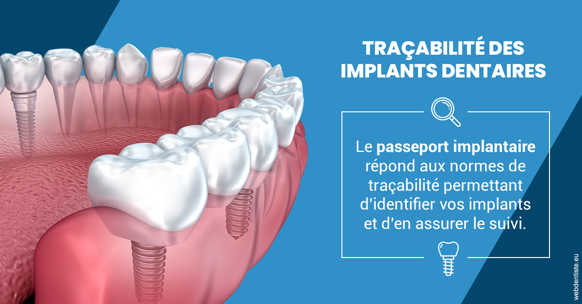 https://dr-doucet-philippe.chirurgiens-dentistes.fr/T2 2023 - Traçabilité des implants 1