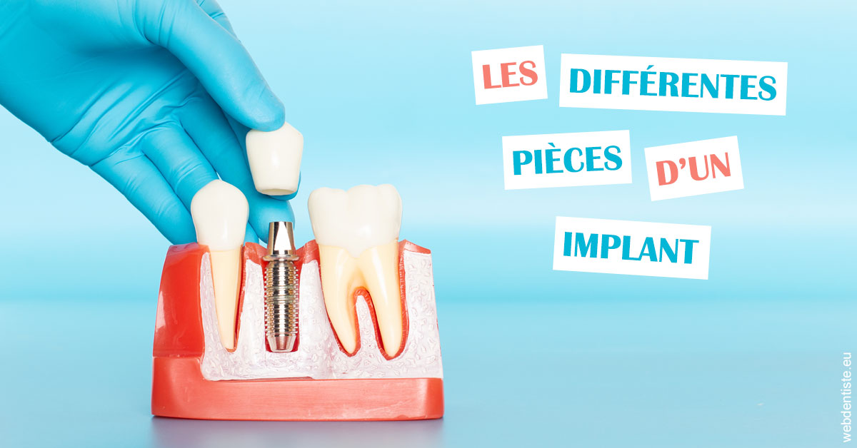 https://dr-doucet-philippe.chirurgiens-dentistes.fr/Les différentes pièces d’un implant 2