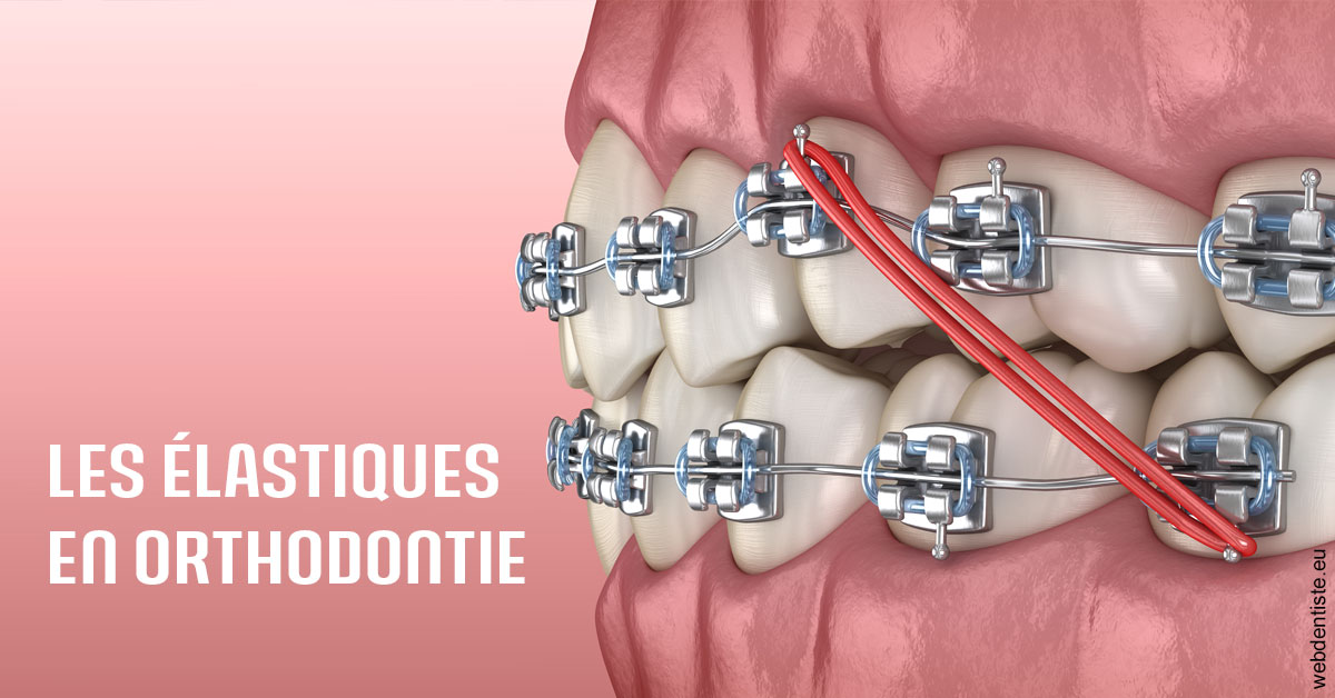 https://dr-doucet-philippe.chirurgiens-dentistes.fr/Elastiques orthodontie 2