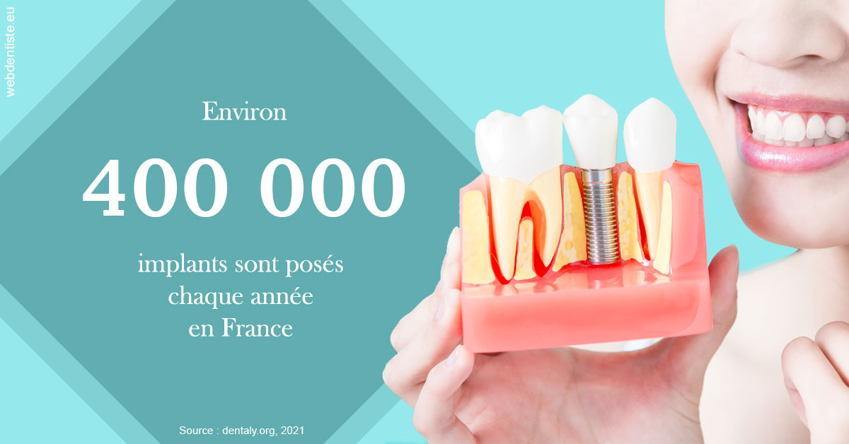 https://dr-doucet-philippe.chirurgiens-dentistes.fr/Pose d'implants en France 2