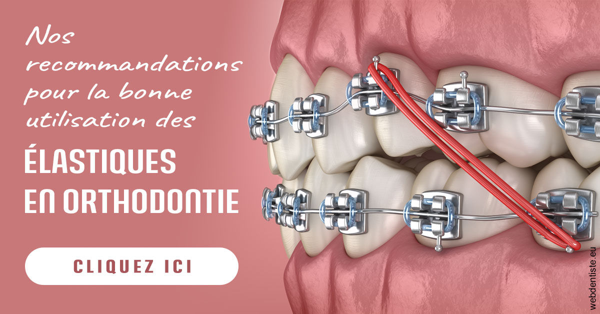 https://dr-doucet-philippe.chirurgiens-dentistes.fr/Elastiques orthodontie 2